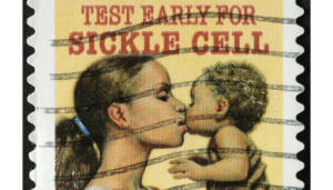 mothe with baby with sickle cell